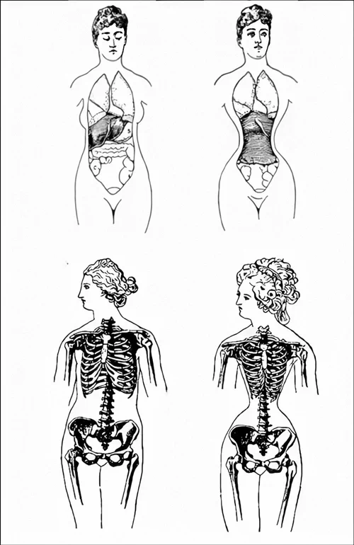 16세기부터 에드워드 시대(1901~1910)에 이르기까지 서구의 여성들이 패션을 완성하기 위해서 빼놓을 수 없었던 필수품이 '코르셋(corset)'이었다. 3